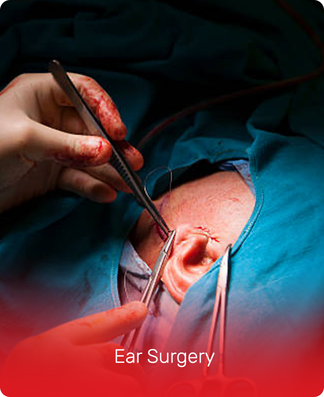 EAR SURGERY