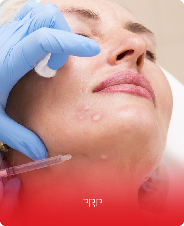 PRP