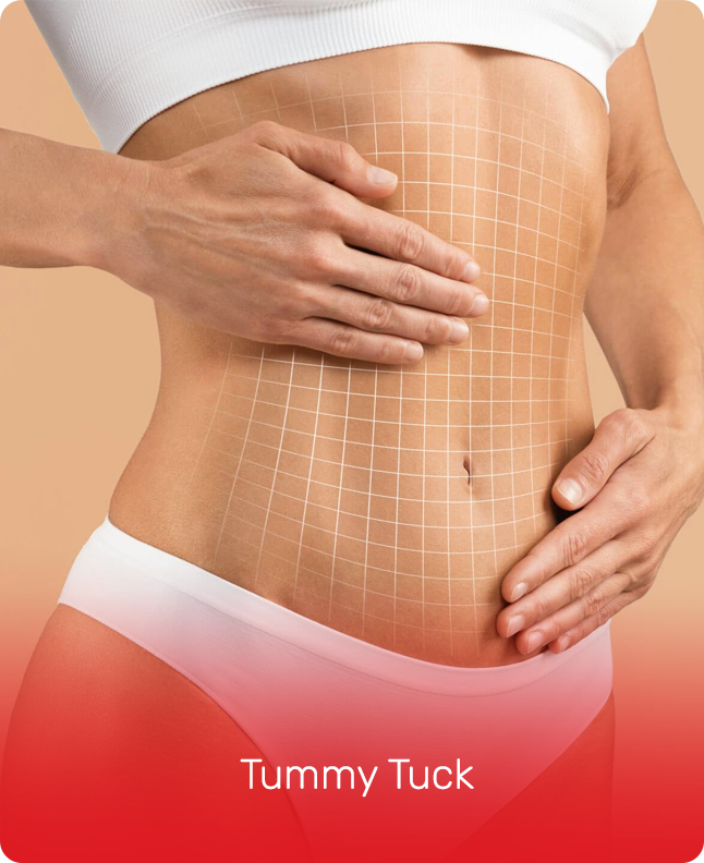 TUMMY TUCK